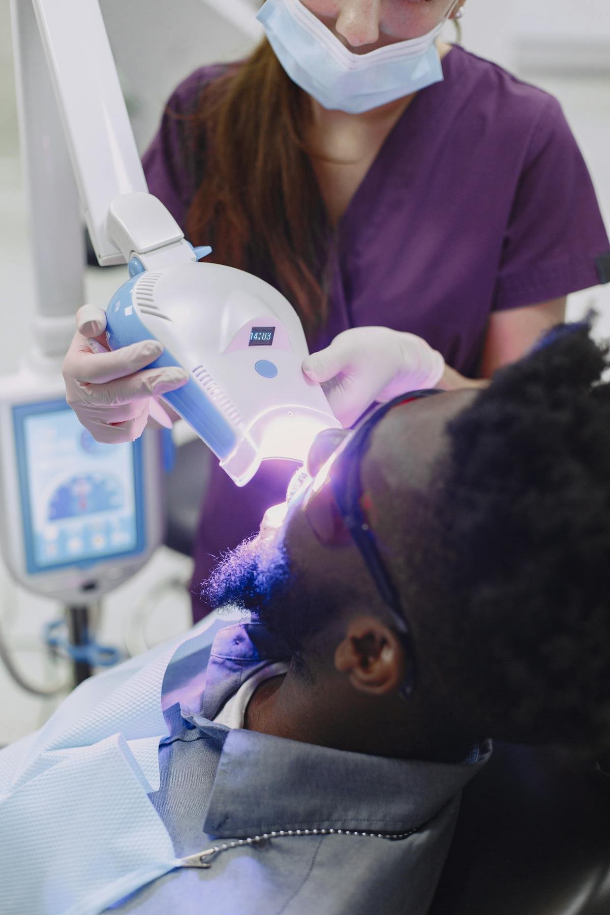Sbiancamento denti professionale con luce LED